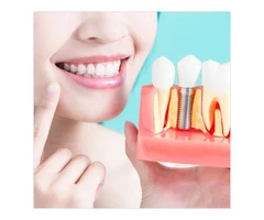 Get Excellent Dental Implant Procedure near Narre Warren