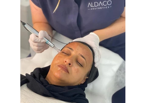 Cosmetic Microneedling