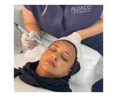 Cosmetic Microneedling