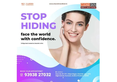 Treatment for Freckles in kurnool