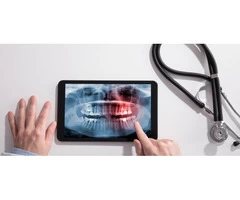 Impacted Wisdom Teeth - Causes Of Tooth Removal