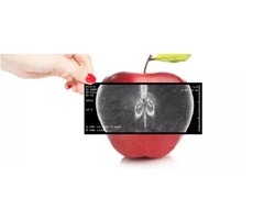 Best Quality X-ray Food Inspection System In Melbourne