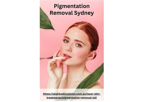 Get the Best Pigmentation Removal Treatment and Improve Your Skin - 1/3