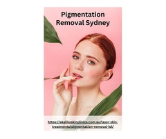 Get the Best Pigmentation Removal Treatment and Improve Your Skin