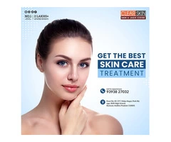 Best Advance Acne Scar Removal Treatment in Kurnool || Laser Treatment