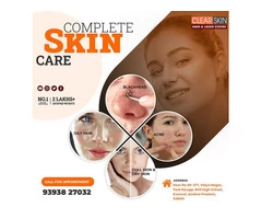 Best Advance Milia Treatment In India || Laser Treatment || Skin Care