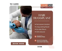 Non-Surgical Laser Hair Removal Men