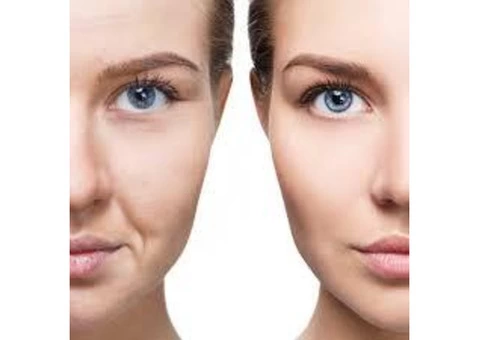 Cosmetic Microneedling