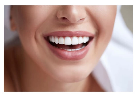 Do you need a gorgeous smile transformation?