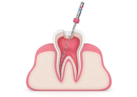 Expert Sleep Apnea Treatments in Melbourne | Melbourne Sleep Solutions - 3/4