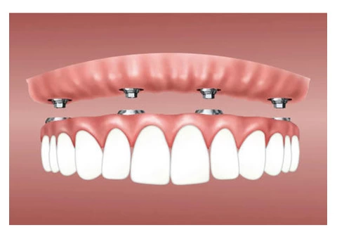 Professional Oral Health Services in Melbourne - Get the Care You Deserve - 6/6