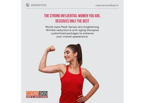 tattoo removal treatment in kurnool