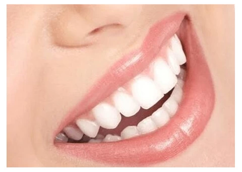 Get Sparkling Teeth With Dental Checkup and Cleaning At United Dental Clinic!