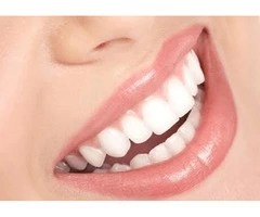 Get Sparkling Teeth With Dental Checkup and Cleaning At United Dental Clinic!