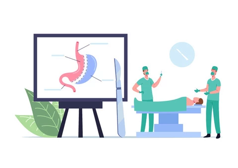 gastric sleeve surgery