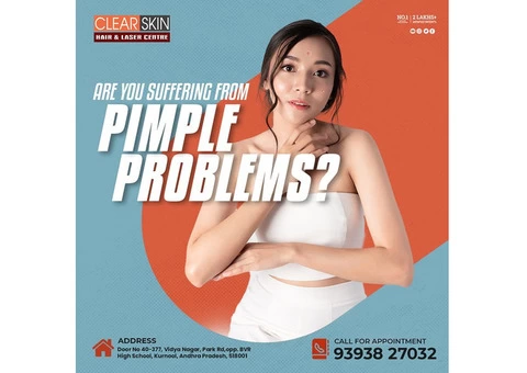 Pulse dye laser treatment in bangalore