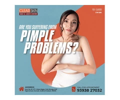 Pulse dye laser treatment in bangalore