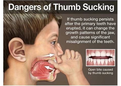 Learn How To Break The Habit Of Thumb Or Finger Sucking from Banksia Grove Dentist