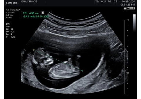 Find Peace of Mind with Our Reassurance Scan Services