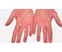 Aesthetic Treatments