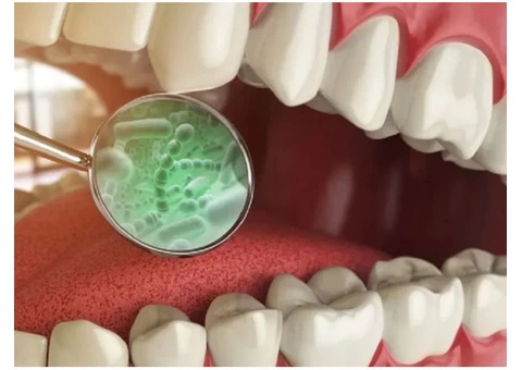 Learn How Often You Should Get a Teeth Cleaning from Banksia Grove Dentist