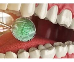 Learn How Often You Should Get a Teeth Cleaning from Banksia Grove Dentist
