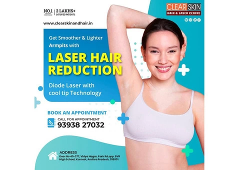 Laser Hair Removal Treatment in hyderabad