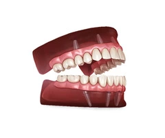 Get Perfect Digital Dentures from Springvale Dental Clinic