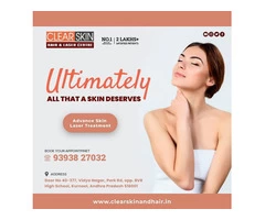 vascular laser treatment in Andhra Pradesh AP