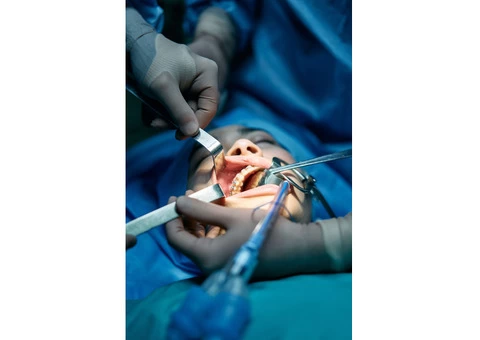 Broken Tooth Treatment in Australia