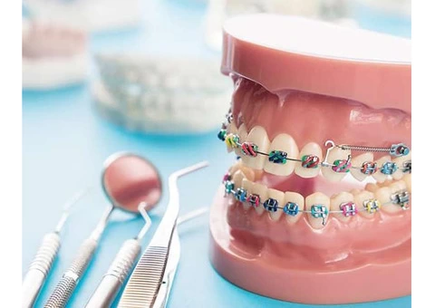 Align your teeth and enhance your oral health with orthodontic dental treatment