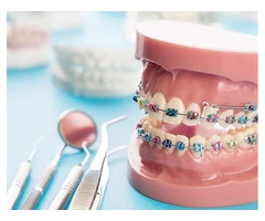 Align your teeth and enhance your oral health with orthodontic dental treatment