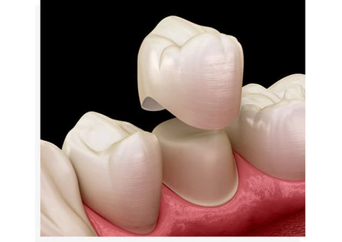 Experience The Best General Dentistry Services at Banksia Grove Dentist