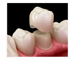 Experience The Best General Dentistry Services at Banksia Grove Dentist