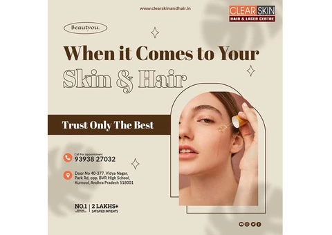 best advanced acne laser treatment in bangalore