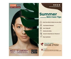 Stretch Marks Laser Treatment In hyderabad