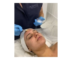 Synergie Chemical Peels
