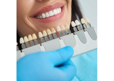 Budget-Friendly Dental Crowns: Restore Your Teeth at an Affordable Cost at Paynless Dental
