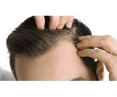 Perfect Quick Cut - Scalp Treatment in Parramatta
