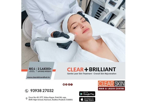 best vascular laser treatment in hyderabad