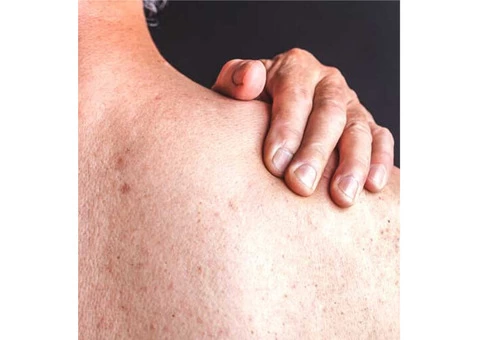Learn About the Common Skin Problems from Compounding Pharmacy in Perth