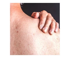 Learn About the Common Skin Problems from Compounding Pharmacy in Perth