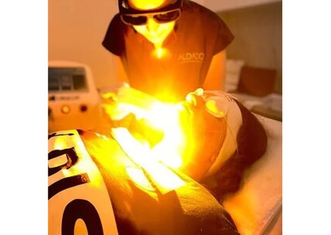 IPL Acne Treatments