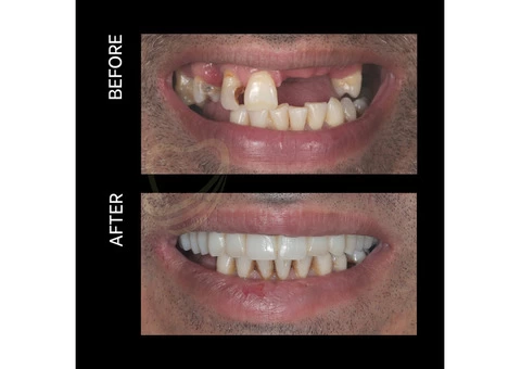 TCare Dental Centre - 1/4