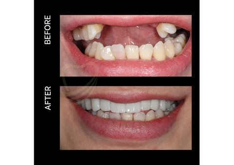 TCare Dental Centre - 2/4