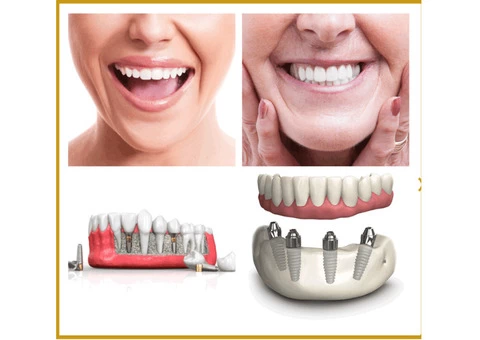 TCare Dental Centre - 3/4