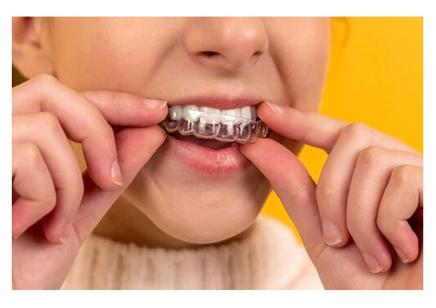 Orthodontic Treatment Baulkham Hills