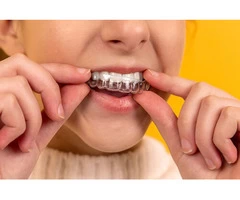 Orthodontic Treatment Baulkham Hills