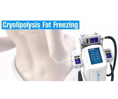 Non-Invasive, Pain-Free Fat Freezing Treatment in the Ponds
