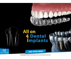 Dental Implants in Perth - Perth Centre for Cosmetic and Implant Dentistry